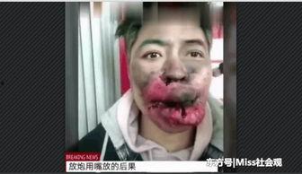 黑料吃黑瓜快手,快手“黑瓜”事件深度剖析