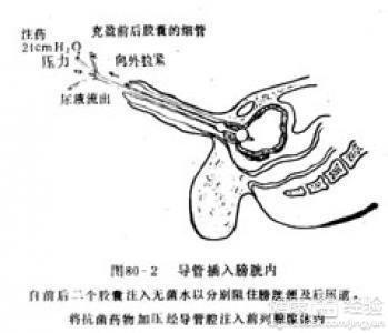 按摩前列腺手法视频,专业指导，轻松掌握